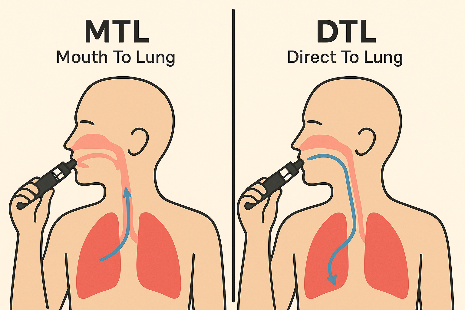 فرق MTL و DTL